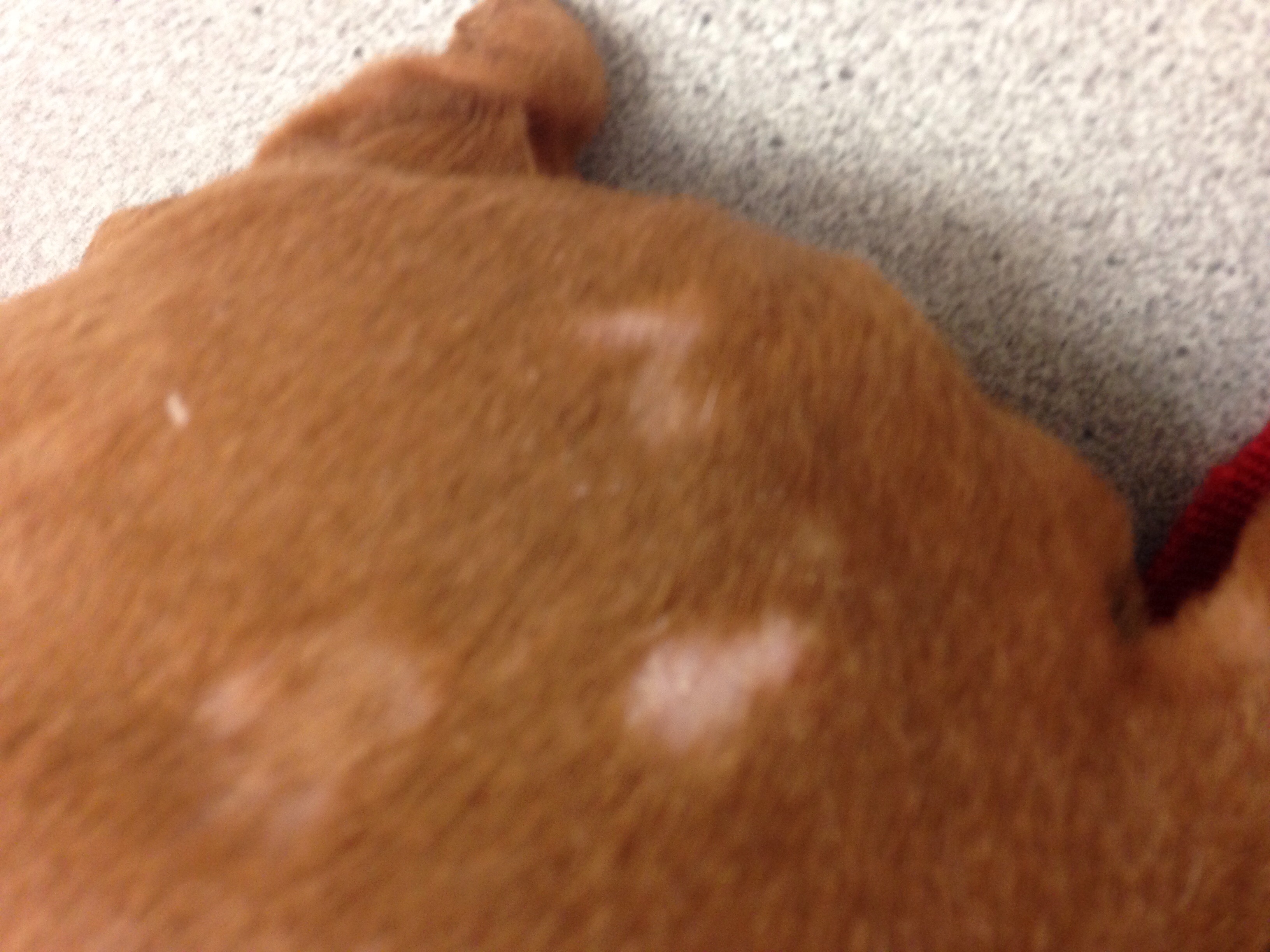 Light Brown Scaly Spots On Skin